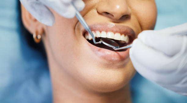 Best Emergency Dental Filling Replacement  in Loch Lomond, VA